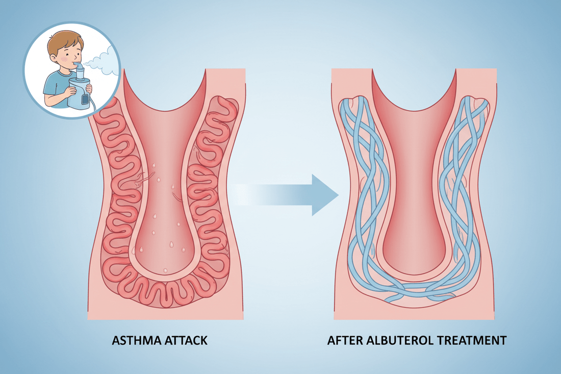 Albuterol nebulizer-How It Works and What It Treats - Portable Nebulizer Story